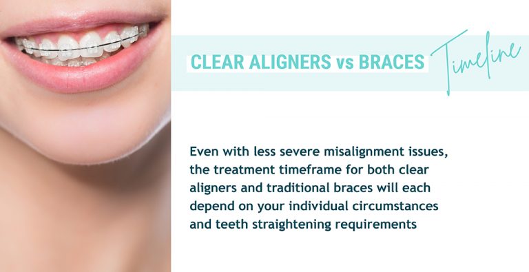 Choosing Between Clear Aligners And Braces Ez Smile